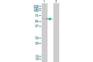 Western Blot analysis of LSM16 expression in transfected 293T cell line by LSM16 monoclonal antibody (M01A), clone 4E3-3A4. (EDC3 antibody  (AA 1-508))