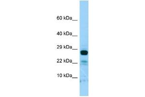 WB Suggested Anti-IL22RA2 Antibody Titration: 1. (IL22RA2 antibody  (C-Term))