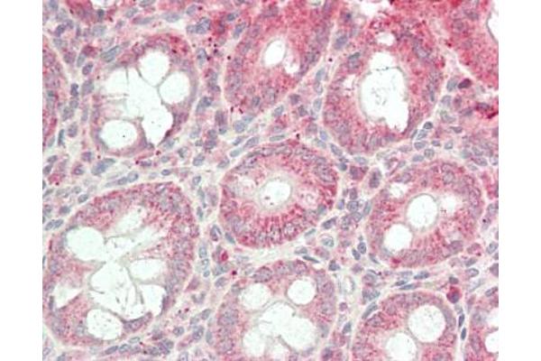 CTDNEP1A antibody  (HRP)