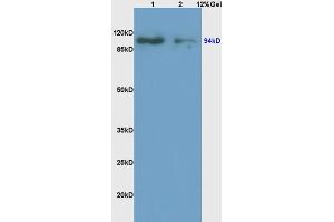 Lane 1: rat brain lysates Lane 2: rat kidney lysates probed with Anti ATG9A Polyclonal Antibody, Unconjugated (ABIN752488) at 1:200 in 4 °C. (ATG9A antibody  (AA 301-400))