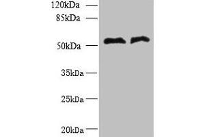 Western blot All lanes: TRIT1 antibody at 3 μg/mL Lane 1: Jurkat whole cell lysate Lane 2: Raji whole cell lysate Secondary Goat polyclonal to rabbit IgG at 1/10000 dilution Predicted band size: 53, 38, 50, 44, 19 kDa Observed band size: 53 kDa (TRIT1 antibody  (AA 1-324))