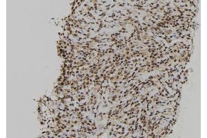 ABIN6272412 at 1/100 staining Human spleen tissue by IHC-P. (RCC2 antibody  (C-Term))