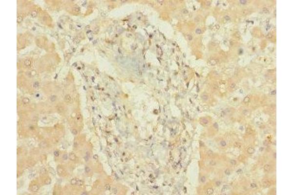 CYP3A7 antibody  (AA 1-200)