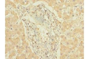 Immunohistochemistry of paraffin-embedded human liver tissue using ABIN7149266 at dilution of 1:100 (CYP3A7 antibody  (AA 1-200))