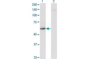 Western Blot analysis of CDR2 expression in transfected 293T cell line by CDR2 monoclonal antibody (M03), clone 4D2. (CDR2 antibody  (AA 1-454))