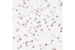 Immunohistochemistry of paraffin-embedded mouse brain using MonoMethyl-Histone H4-R3 antibody (ABIN1680263, ABIN1680264, ABIN6220110 and ABIN6220114) at dilution of 1:100 (40x lens). (Histone H4 antibody  (meArg3))