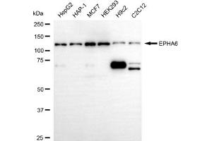 anti-EPH Receptor A6 (Epha6) antibody