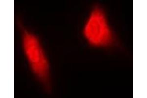 Immunofluorescent analysis of MGCRACGAP staining in HeLa cells. (RACGAP1 antibody)