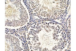 ABIN7096438 and ABIN7100502 at 1/100 staining rat testis tissue by IHC-P. (GRAMD1B antibody)