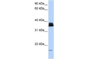 WB Suggested Anti-PPIA Antibody Titration:  0.