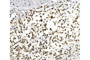 IHC analysis of JUNB using anti-JUNB antibody (ABIN7603223).