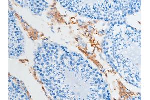 ABIN6267252 at 1/100 staining rat testicular tissue sections by IHC-P. (CHEK2 antibody  (pSer516))