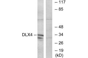 Western blot analysis of extracts from COLO cells, using DLX4 antibody. (DLX4 antibody  (Internal Region))