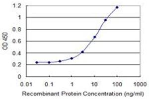 Detection limit for recombinant GST tagged RIOK2 is 0. (RIOK2 antibody  (AA 453-551))
