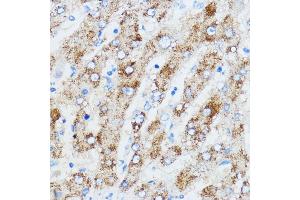 Immunohistochemistry (IHC) image for anti-Insulin-Like Growth Factor 2 mRNA Binding Protein 3 (IGF2BP3) (AA 300-579) antibody (ABIN6142245)