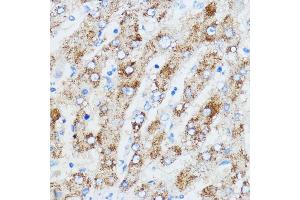 Immunohistochemistry of paraffin-embedded human liver using IGF2BP3 antibody (ABIN6131800, ABIN6142245, ABIN6142246 and ABIN6221706) at dilution of 1:100 (40x lens). (IGF2BP3 antibody  (AA 300-579))