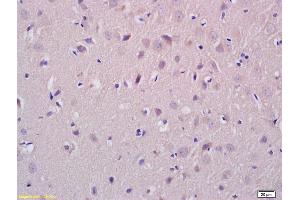 Formalin-fixed and paraffin embedded rat brain tissue labeled with Anti-ATX2 Polyclonal Antibody, Unconjugated (ABIN872411) at 1:200, followed by conjugation to the secondary antibody and DAB staining (Ataxin 2 antibody  (AA 775-856))
