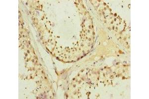 Immunohistochemistry of paraffin-embedded human testis tissue using ABIN7157660 at dilution of 1:100 (KIFC3 antibody  (AA 140-390))