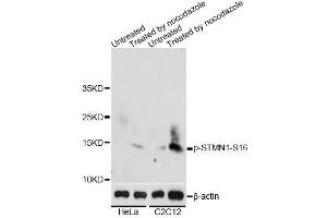 Western blot analysis of extracts of HeLa and C2C12 cells, using Phospho-STMN1-S16 antibody (ABIN2987668) at 1/2000 dilution. (Stathmin 1 antibody  (pSer16))
