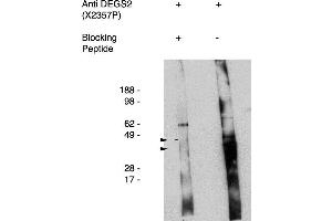Western blot using antigen immunoaffinity purified anti DEGS2 antibody , used at 1:50k dilution. (DEGS2 antibody)