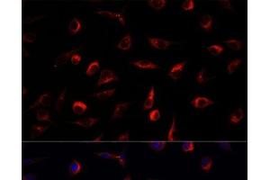 Immunofluorescence analysis of L929 cells using MAP2K7 Polyclonal Antibody at dilution of 1:100. (MAP2K7 antibody)