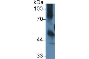 Detection of ICAM1 in Mouse Thymus lysate using Polyclonal Antibody to Intercellular Adhesion Molecule 1 (ICAM1) (ICAM1 antibody  (AA 328-465))