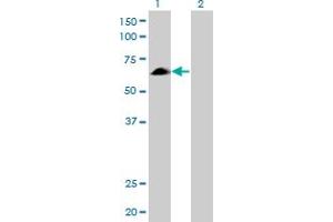 Western Blot analysis of EYA2 expression in transfected 293T cell line by EYA2 monoclonal antibody (M04), clone 2F8. (EYA2 antibody  (AA 164-271))