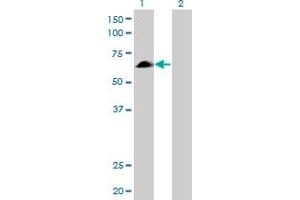 Western Blot analysis of EYA2 expression in transfected 293T cell line by EYA2 monoclonal antibody (M04), clone 2F8.