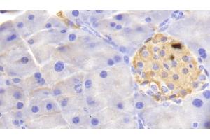 Detection of HBb in Mouse Pancreas Tissue using Polyclonal Antibody to Hemoglobin Beta (HBb) (Hemoglobin Subunit beta antibody  (AA 1-147))