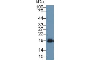 Detection of SOD1 in Mouse Bladder lysate using Polyclonal Antibody to Superoxide Dismutase 1 (SOD1) (SOD1 antibody  (AA 2-154))