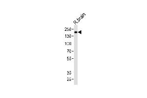 Western blot analysis of lysate from rat brain tissue, using Mouse Insrr Antibody (C-term) (ABIN6243236 and ABIN6577628). (INSRR antibody  (C-Term))