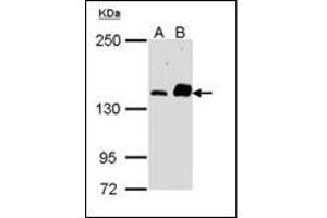 Sample (30 µg of whole cell lysate). (CARD11 antibody)