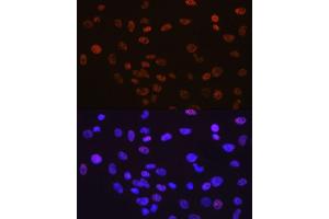 Immunofluorescence (IF) image for anti-YY1 Transcription Factor (YY1) antibody (ABIN7271428)