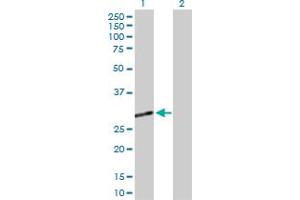 Western Blot analysis of CECR1 expression in transfected 293T cell line by CECR1 MaxPab polyclonal antibody. (CECR1 antibody  (AA 1-270))