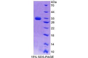 SDS-PAGE (SDS) image for Notch 4 (NOTCH4) (AA 1690-1945) protein (His tag) (ABIN2126128)