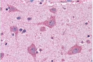 ABIN184846 (3. (ACSL4 antibody  (C-Term))