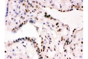 IHC analysis of RbAp48 using anti-RbAp48 antibody . (Retinoblastoma Binding Protein 4 antibody  (C-Term))