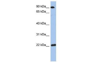 TMED10 antibody used at 1 ug/ml to detect target protein. (TMED10 antibody)