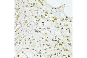 Immunohistochemistry of paraffin-embedded human vermiform appendix using TRIM15 antibody (ABIN5999102) at dilution of 1/100 (40x lens).