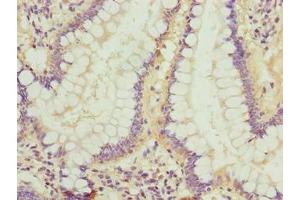 Immunohistochemistry of paraffin-embedded human small intestine tissue using ABIN7158182 at dilution of 1:100 (LRRC42 antibody  (AA 201-428))