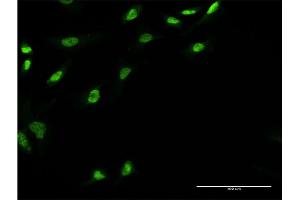 Immunofluorescence of monoclonal antibody to UBE2E3 on HeLa cell. (UBE2E3 antibody  (AA 65-152))