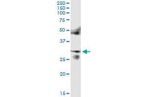 Immunoprecipitation of FOSL2 transfected lysate using anti-FOSL2 MaxPab rabbit polyclonal antibody and Protein A Magnetic Bead , and immunoblotted with FOSL2 purified MaxPab mouse polyclonal antibody (B01P) . (FOSL2 antibody  (AA 1-326))
