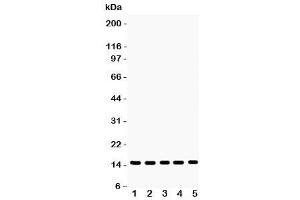 Western blot testing of Profilin-1 antibody and Lane 1:  rat testis (PFN1 antibody  (C-Term))