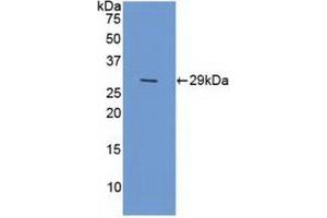 Detection of Recombinant XPG, Human using Polyclonal Antibody to Xeroderma Pigmentosum, Complementation Group G (XPG) (ERCC5 antibody  (AA 778-986))
