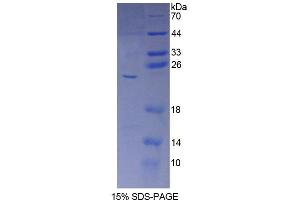 SDS-PAGE analysis of Human CYP5A1 Protein. (TBXAS1 Protein)