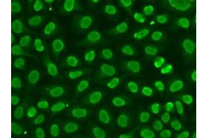 Immunofluorescence (IF) image for anti-Flap Structure-Specific Endonuclease 1 (FEN1) (AA 50-380) antibody (ABIN3021632)