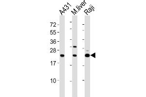 All lanes : Anti-PSMB9 Antibody (C-term) at 1:2000 dilution Lane 1: A431 whole cell lysates Lane 2: mouse liver lysates Lane 3: Raji whole cell lysates Lysates/proteins at 20 μg per lane. (PSMB9 antibody  (C-Term))