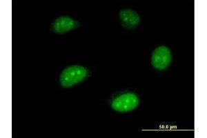 Immunofluorescence of monoclonal antibody to ISG20 on HeLa cell.