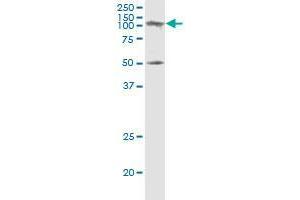 SAGE1 monoclonal antibody (M02), clone 5C1. (SAGE1 antibody  (AA 357-455))