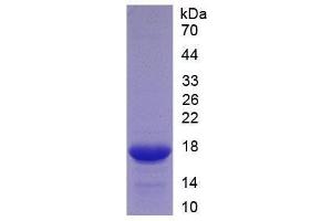 Image no. 1 for Tumor Necrosis Factor (Ligand) Superfamily, Member 12 (TNFSF12) (AA 148-247) protein (His tag) (ABIN1171526)